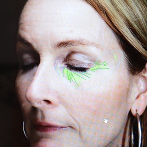 Before The Solution Collagen Heidi