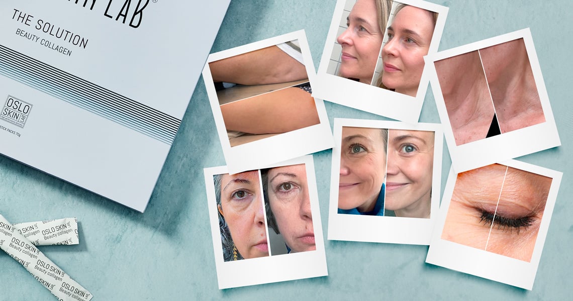 Before and after images of women taking the The Solution