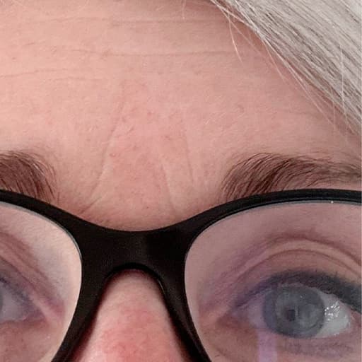 After The Solution Collagen Brit
