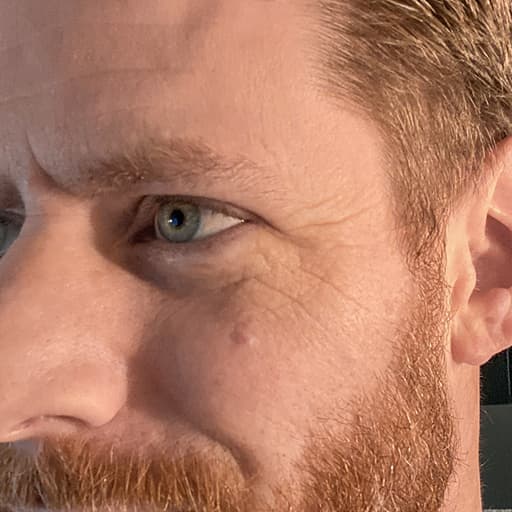 After The Solution Collagen Jesse