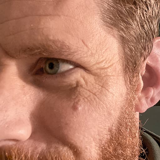 Before The Solution Collagen Jesse