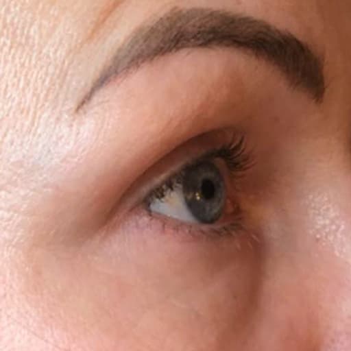 After The Solution Collagen Michelle