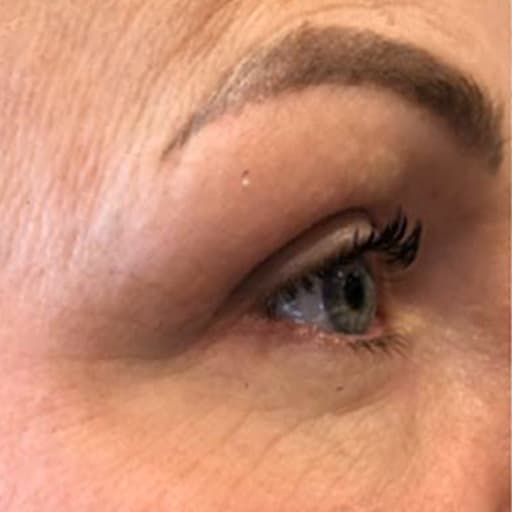 Before The Solution Collagen Michelle