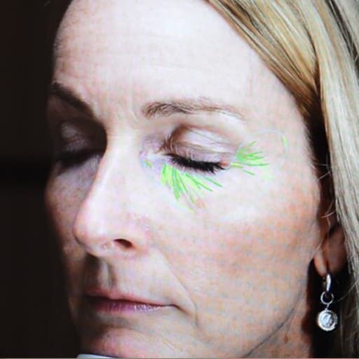 After The Solution Heidi