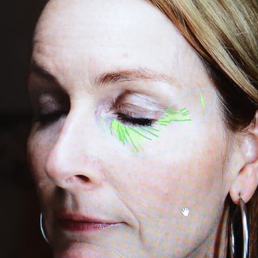 Before The Solution Collagen Heidi