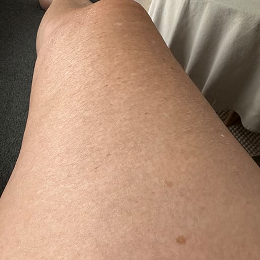 After The Solution Collagen Jette