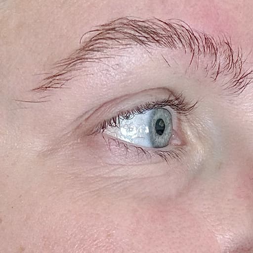 Before The Solution Collagen Magda