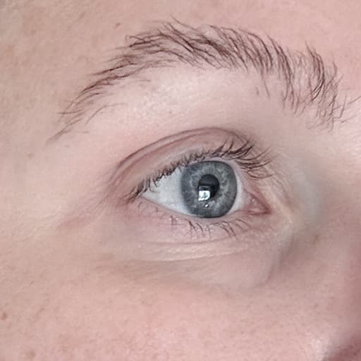 After The Solution Collagen Magda